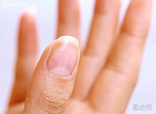 手指甲上的月牙是怎么回事？半月痕与五指关系